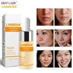 OMY LADY LANBENA Vitamin C Essence Skin Care Whitening Serum Hyaluronic Acid Face Cream Snail Remover Freckle Spots Anti-aging